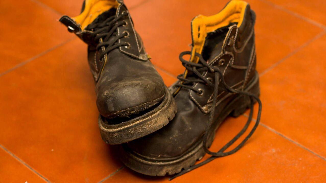boty jsou jednou z příčin plísňových infekcí